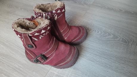 Čižmičky, protetika,20