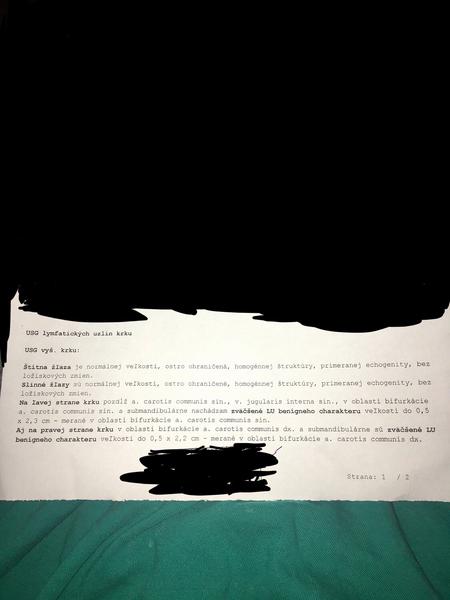 Bolo by na sone krku vidieť, ak by som mal trombózu alebo stenózu žily a tepny?