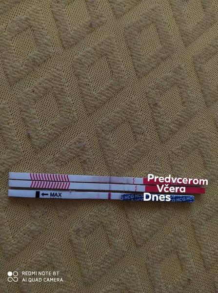 Je silnejšia dnešná čiarka?