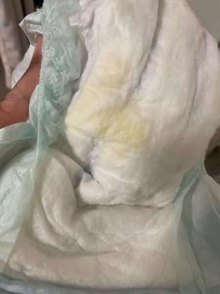 Prečo má 5-mesačná dcéra žltý moč?