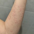 neviete mi niekto poradit co to je celu