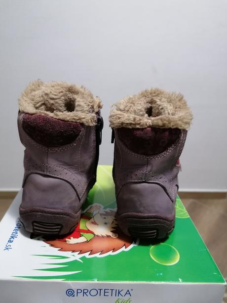 Krasne zimné topánočky protetika, protetika,24