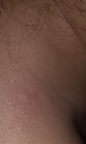 Čo môže spôsobovať svrbiacu vyrážku u dieťaťa?