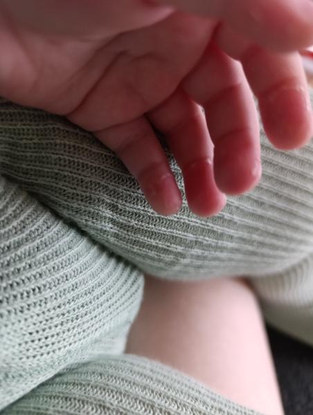 Je normálne, že sa po kiahňach šúpe koža?