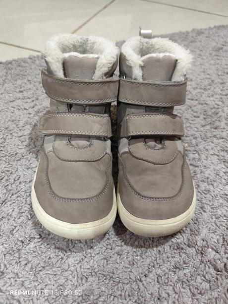 Protetika bf čižmičky, protetika,33