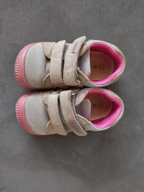 Barefoot tenisky, protetika,25