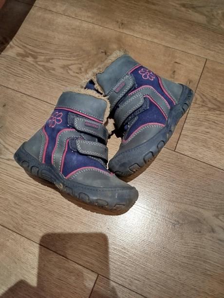 Čižmičky protetika, protetika,24