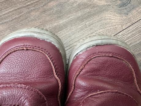 Protetika prechodné topánky, protetika,33