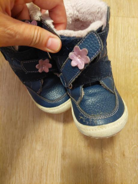 Zimne protetika 24, protetika,24