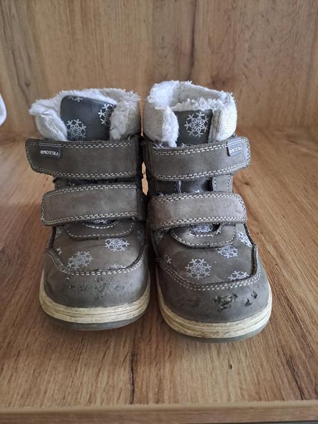 Zimne topánočky, protetika,23