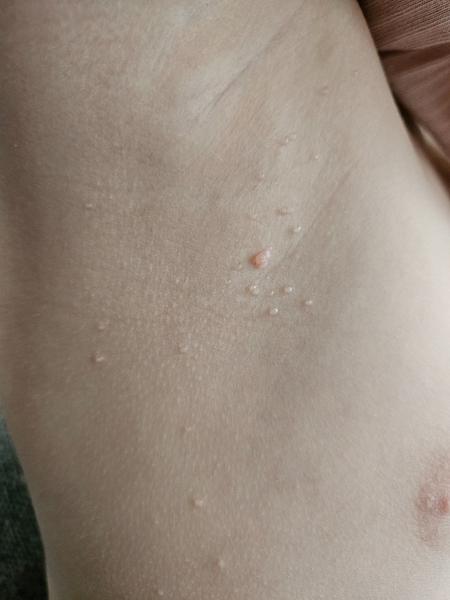 Sú to molusky alebo niečo iné?