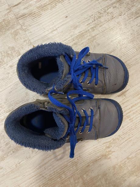 Protetika amis, protetika,30