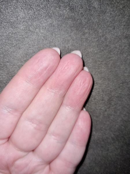 Prečo sa mi zvráskavujú prsty bez vody?