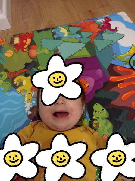 Znamenajú fľaky na líčkach po príkrmoch alergiu?