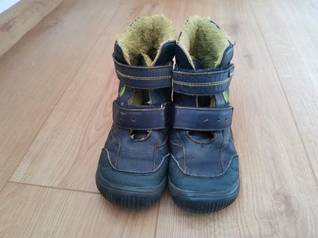 Protetika toren navy 33, protetika,33