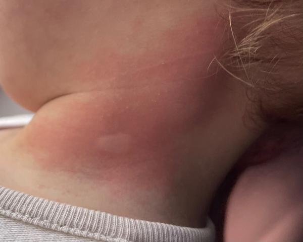 Čo to má malý na krku?