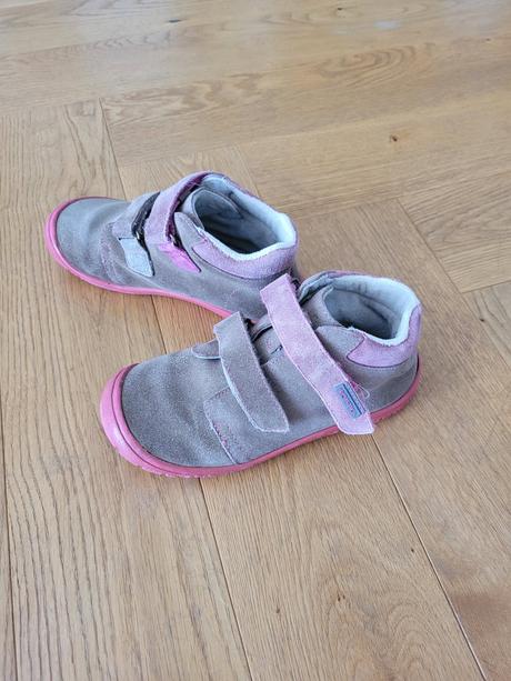 Topanky protetika, protetika,31