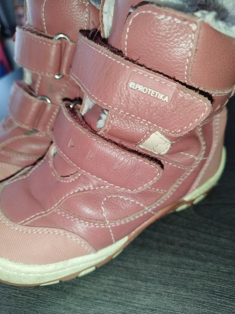 Zimne topánky, protetika,26