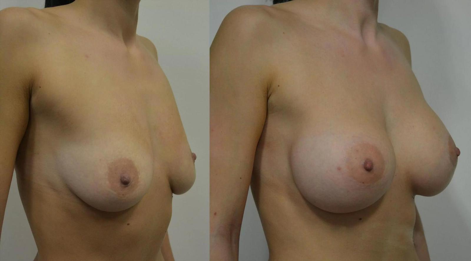 Image title Image title