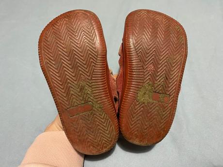 Protetika sandalky, protetika,24