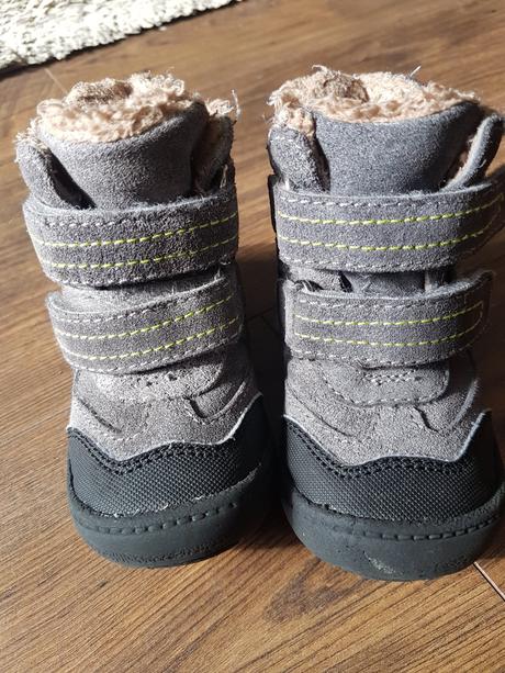 Zimné čižmy protetika, protetika,20