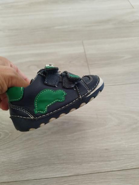 Kožené tenisky, protetika,19