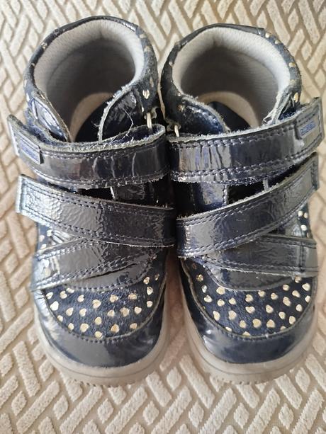 Protetika prechodné barefoot topánky, protetika,26