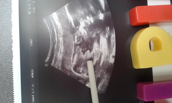 Ako často sa mýlia v dnešnej dobe pri určovaní pohlavia?