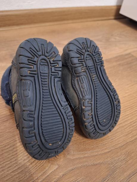 Čižmy protetika, protetika,21