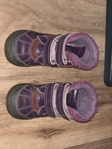 Zimne cizmy protetika, protetika,23