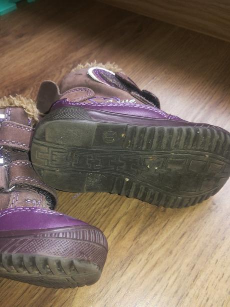 Zimné čižmičky, protetika,19