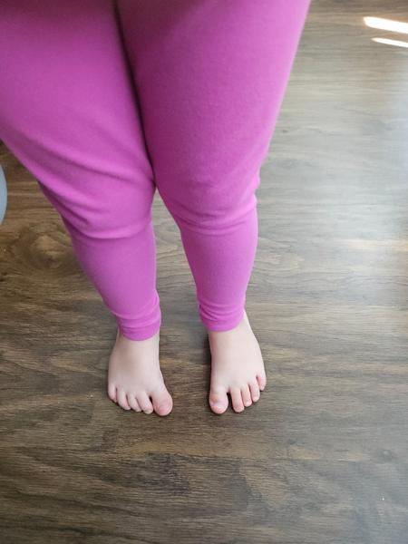 Ako pomôcť dieťaťu s vybočeným prstom na nohe?