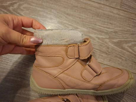 Zimne topanky protetika, protetika,32