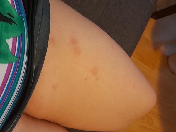 Doštípali ma ploštice?