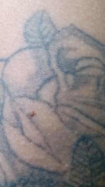 Kožné problémy: Hľadáte pomoc a riešenia?