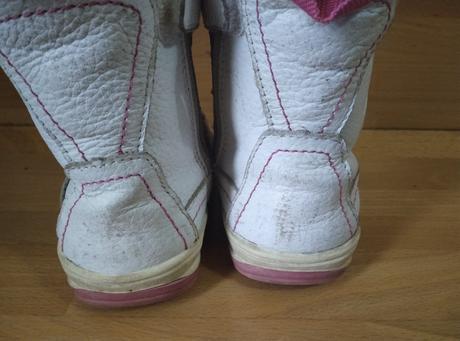 Čižmy 21, protetika,21