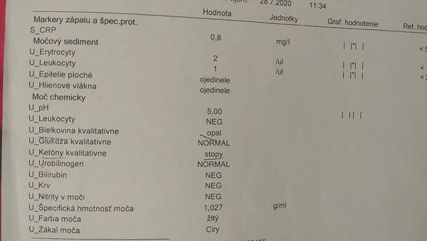 Prečo mám v moči biele vločky?