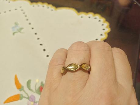 Prsteň chir. oceľ veľkosť 53, 