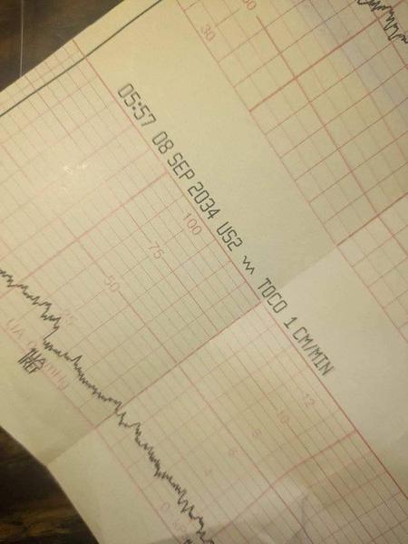 Čo tu znamená "1 cm"?