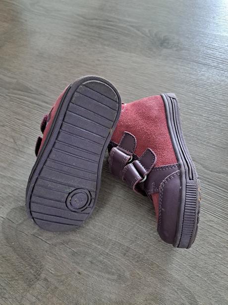 Prechodné topanky, protetika,24