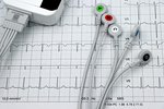 Je Holter na kardiologickej ambulancii bezplatný?