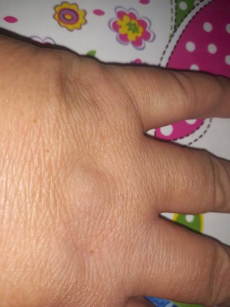 Otázka ohľadne imunologických výsledkov