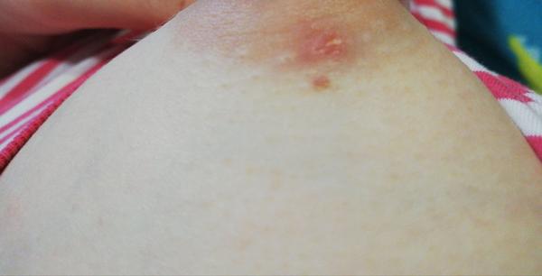 Akú chrastičku to mám na prsníku?