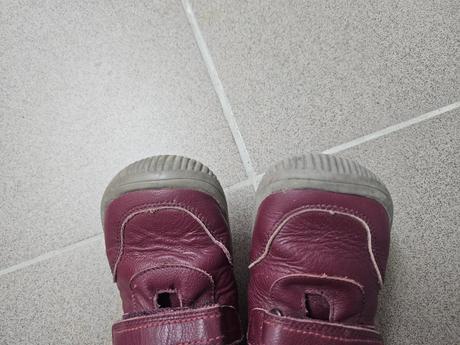 Prechodné topánky, protetika,31