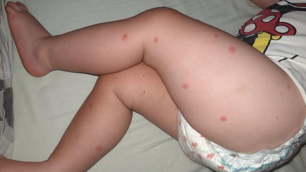 Má moja dcéra kiahne?