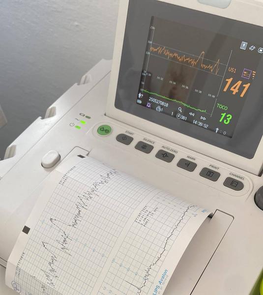 Skákajúci tep bábätka v 37. týždni tehotenstva