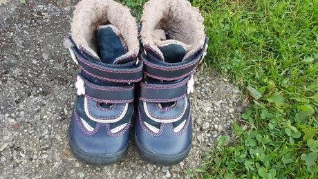 Cizmicky protetika, protetika,25