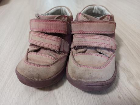 Prechodné topánky, protetika,24