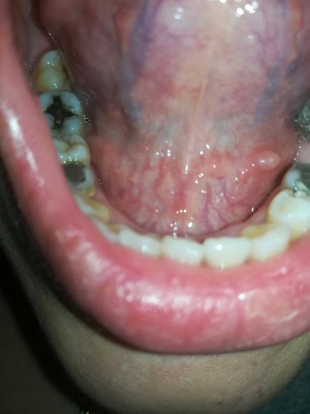 Čo to mám nad jazykom?