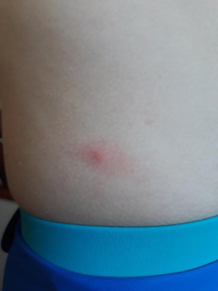 Sú to ovčie kiahne?